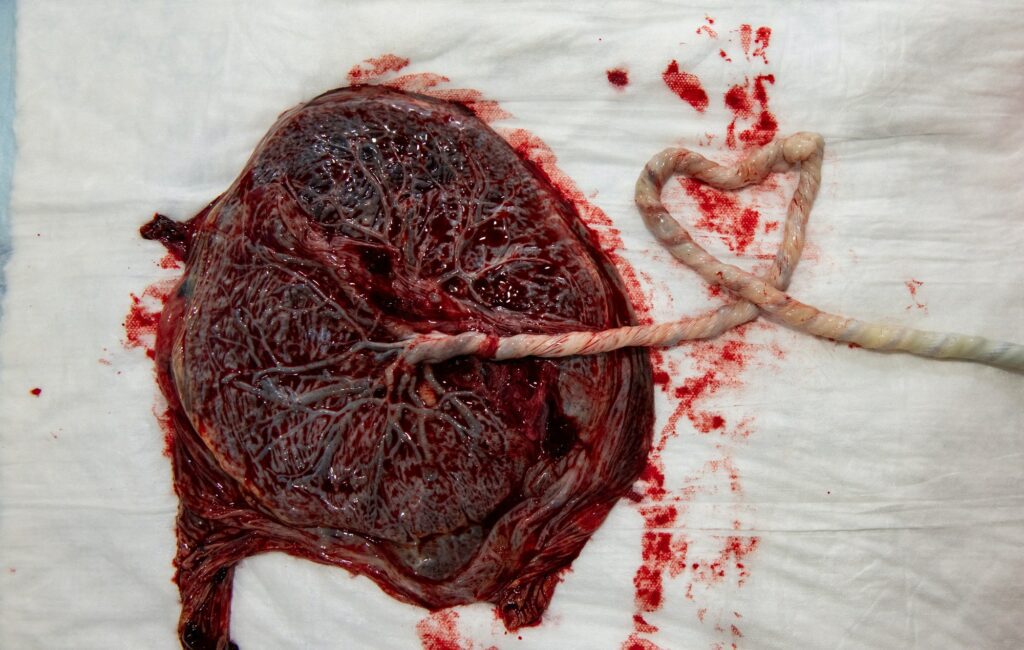 Placenta