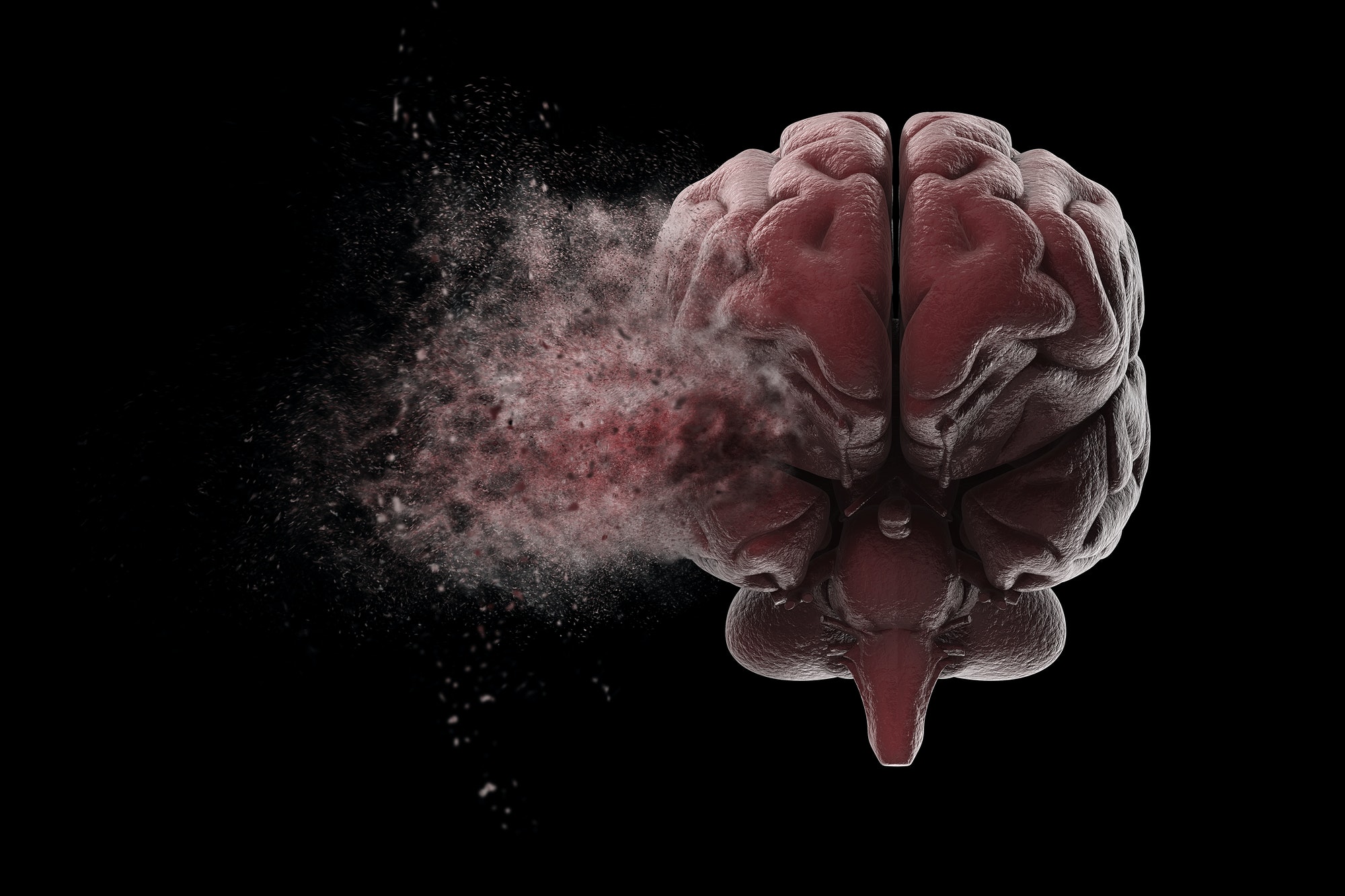 Trombose cerebral