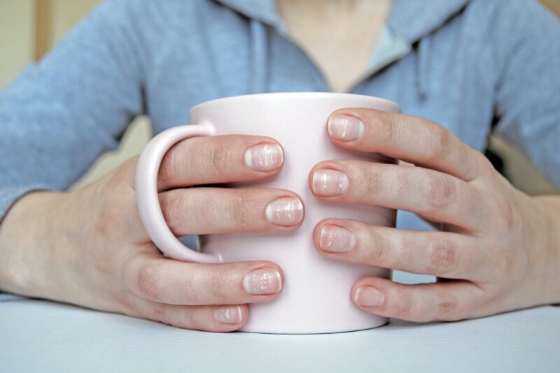 Vitaminas para as Unhas