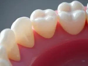 Periodontite Avançada: A Verdade Que Seu Dentista Não Conta