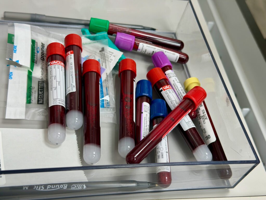 Cansaço e dor no corpo não confirmam deficiência de vitamina D