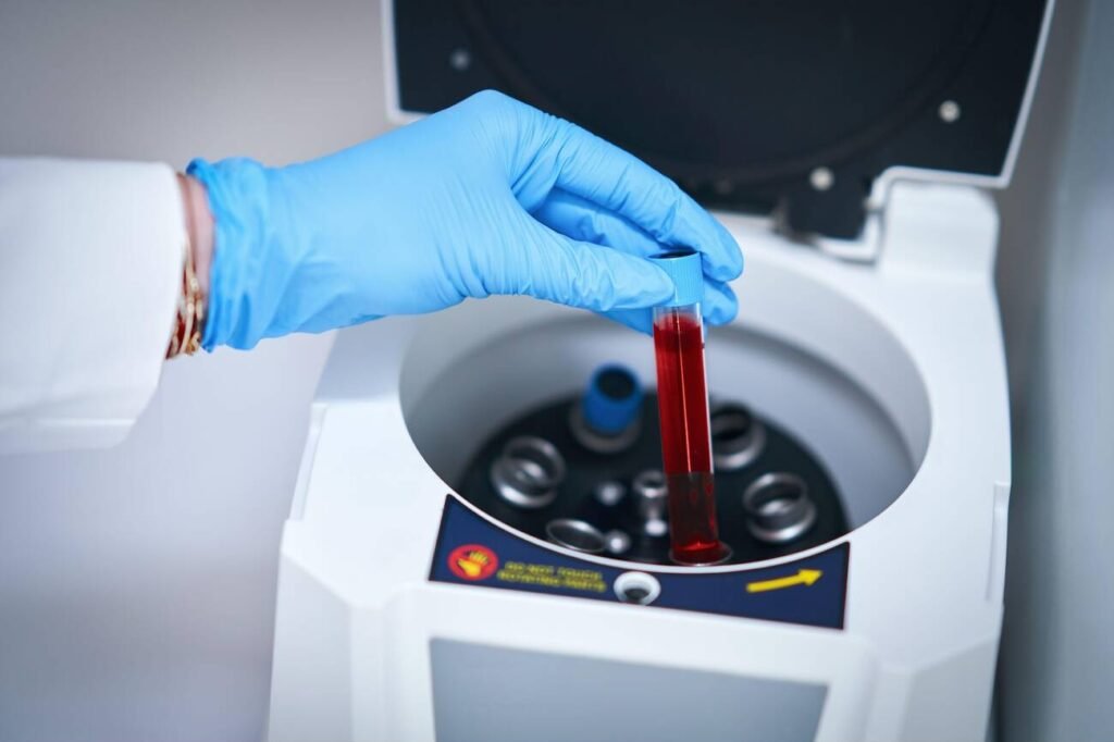 Alzheimer: primeiro exame de sangue aprovado pela Anvisa chega ao Brasil Alzheimer: primeiro exame de sangue aprovado pela Anvisa chega ao Brasil