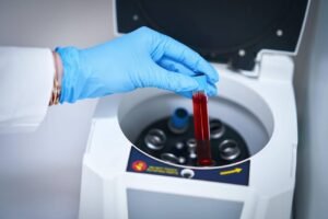 Alzheimer: primeiro exame de sangue aprovado pela Anvisa chega ao Brasil