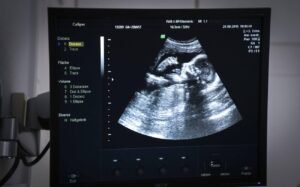Gravidez após aborto espontâneo: mãe conta como vive nova gestação com a filha